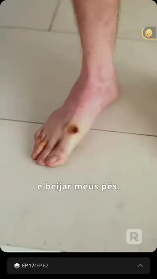 Parte 06 de Minha Visão De Raio X: Vendo Através De Você